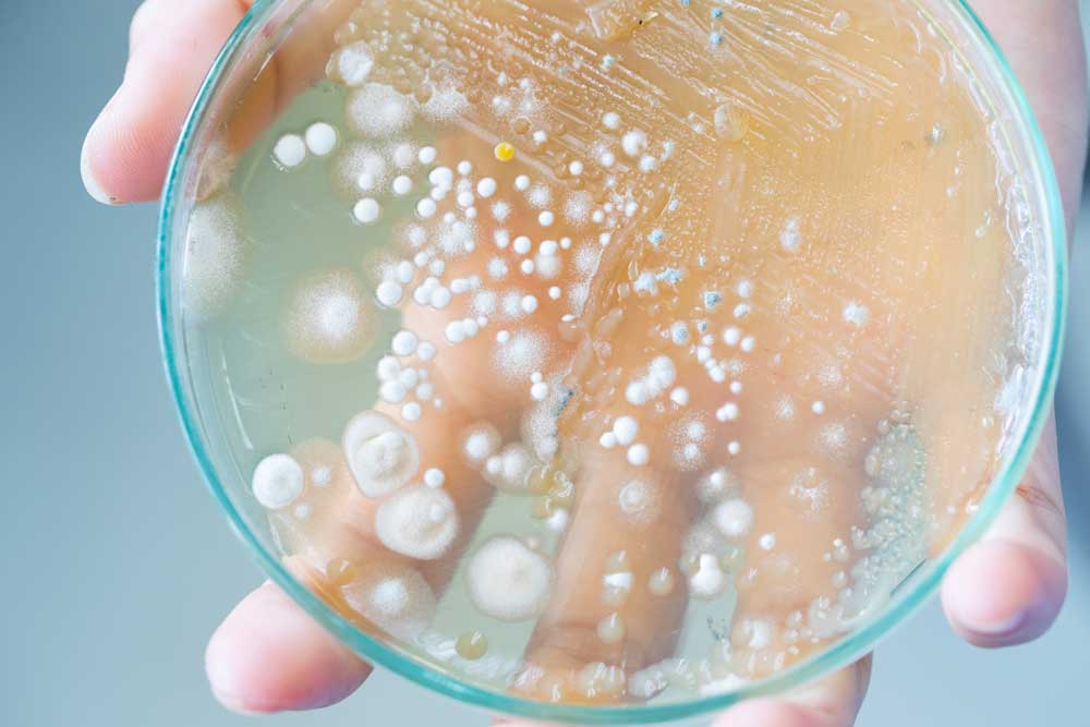 E-les microbiologie en hygiene